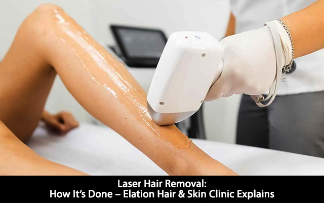 Laser Hair Removal: How It’s Done – Elation Hair & Skin Clinic Explains