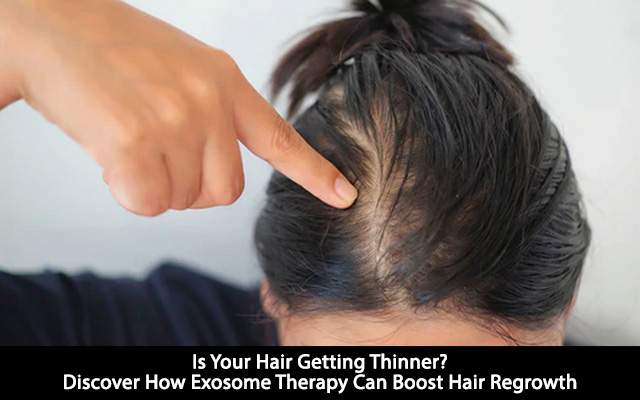 Is Your Hair Getting Thinner? Discover How Exosome Therapy Can Boost Hair Regrowth