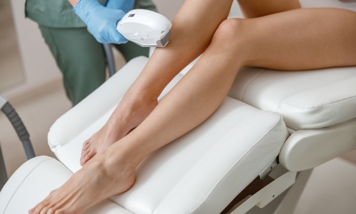 Laser Hair Removal Laser Hair Removal