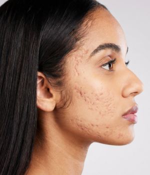 who needs the treatment