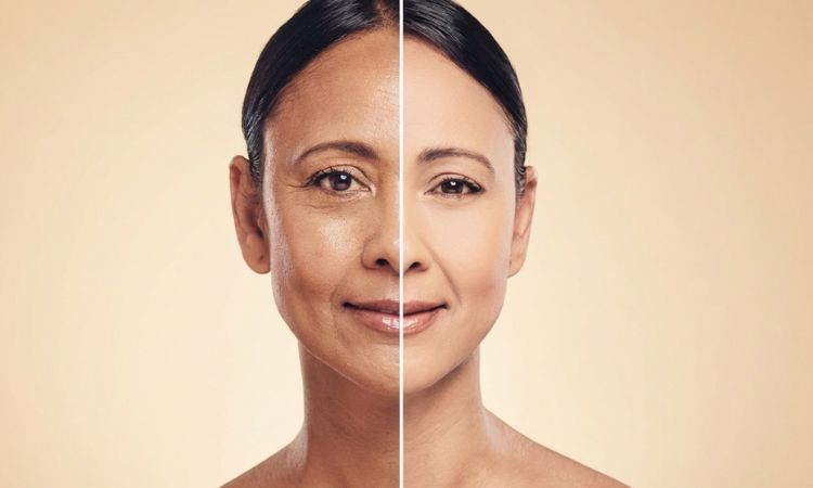 Anti-Ageing Before-After