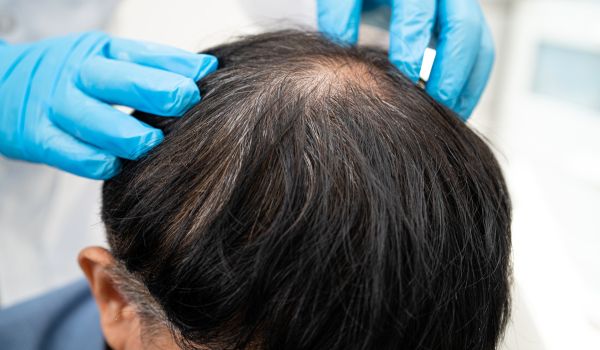 who needs the treatment