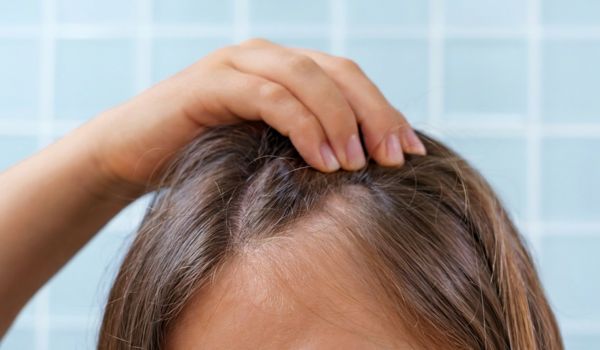 who needs the treatment