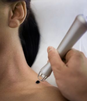 who needs the treatment