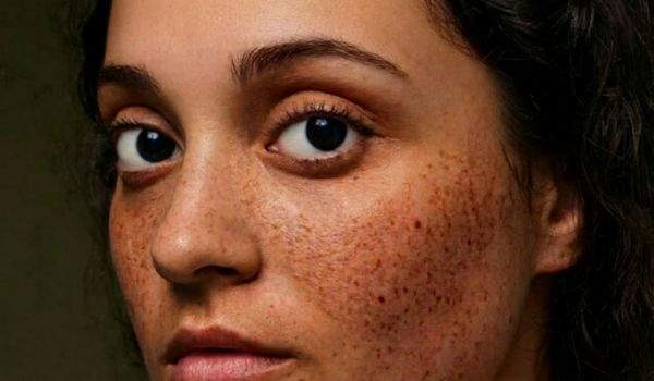 who needs the treatment