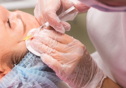 Profhilo – Skin Boosters