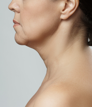 who needs the treatment