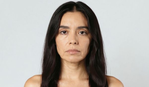 who needs the treatment