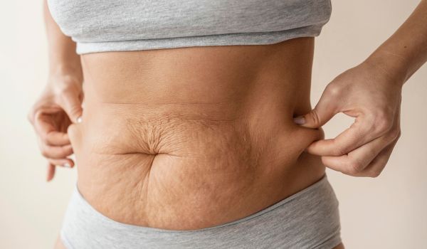 who needs the treatment