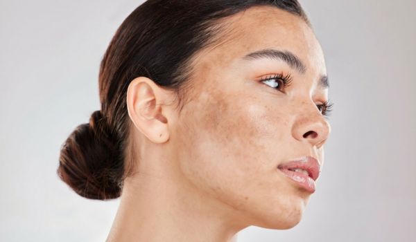 who needs the treatment