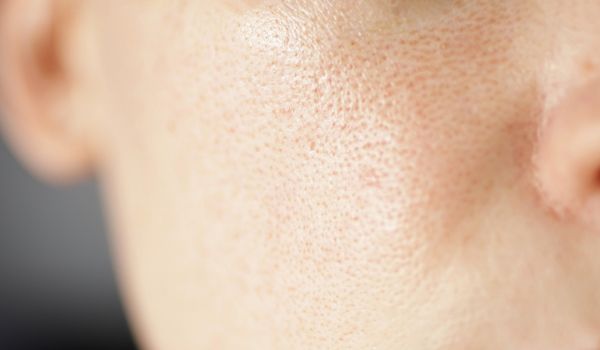 who needs the treatment