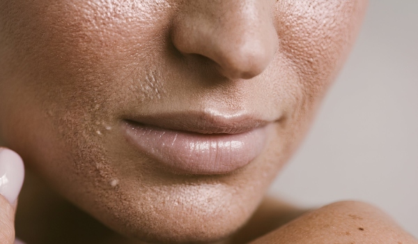 who needs the treatment