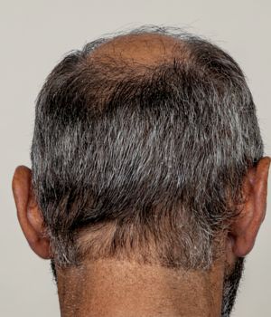 who needs the treatment