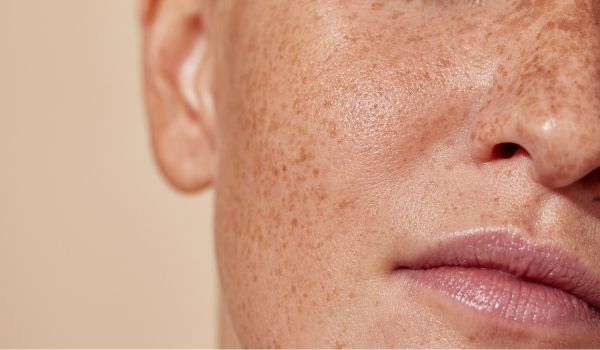 who needs the treatment