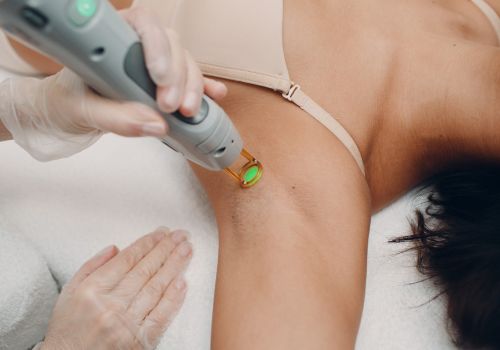 laser hair reduction.