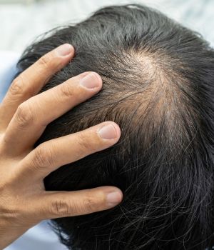 who needs the treatment