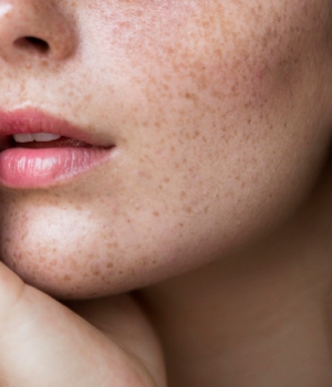 who needs the treatment