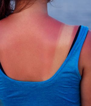 who needs the treatment