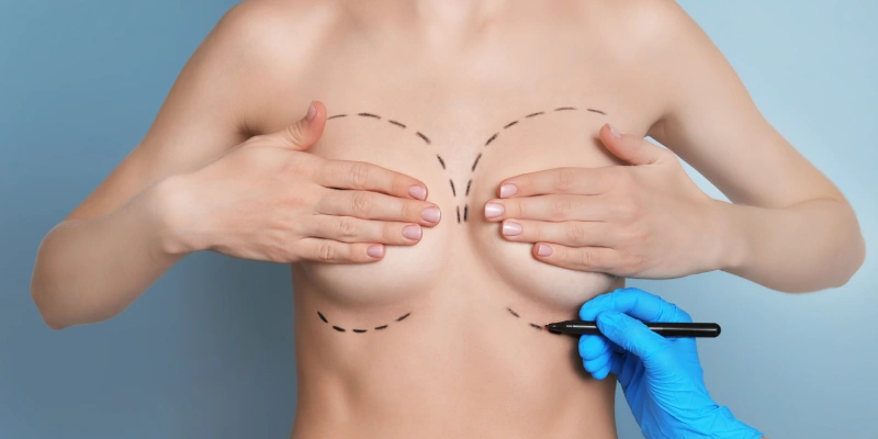 Breast Augmentation | Elation Skin & Hair