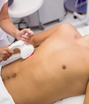 Chest Hair Transplant | Elation Skin & Hair who needs the treatment