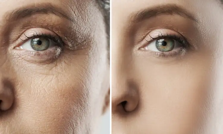 Morpheus Treatment in Kolkata | Elation Skin & Hair