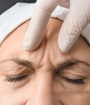 Morpheus Treatment in Kolkata | Elation Skin & Hair Morpheus Treatment in Kolkata | Elation Skin & Hair