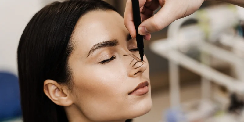 Rhinoplasty Surgery | Elation Skin & Hair